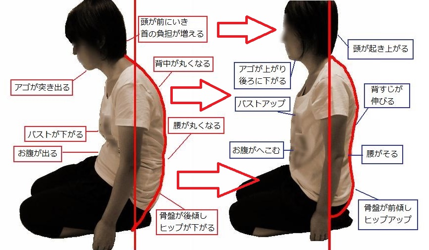椎間板ヘルニア/脊柱管狭窄症/腰痛/治し方/治療法/整体/鬼頭健康院/長久手市/名古屋市/尾張旭市/日進市