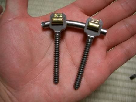 脊柱管狭窄症の手術で使った金具