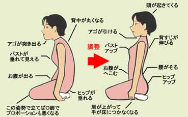 椎間板ヘルニア/脊柱管狭窄症/腰痛/治し方/治療法/整体/鬼頭健康院/長久手市/名古屋市/尾張旭市/日進市