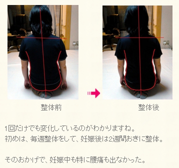 不妊/妊娠/不育/妊活/腰痛/治し方/治療法/整体/鬼頭健康院/長久手市/名古屋市/尾張旭市/日進市